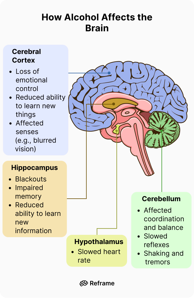 Sơ đồ minh họa tác động của nồng độ cồn lên não bộ qua các giai đoạn (từ hưng phấn đến hôn mê)