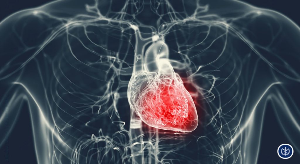 Cap Nhat Phac Do Dieu Tri Tang Huyet Ap Theo Khuyen Cao ESC ISH