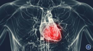 Cap Nhat Phac Do Dieu Tri Tang Huyet Ap Theo Khuyen Cao ESC ISH